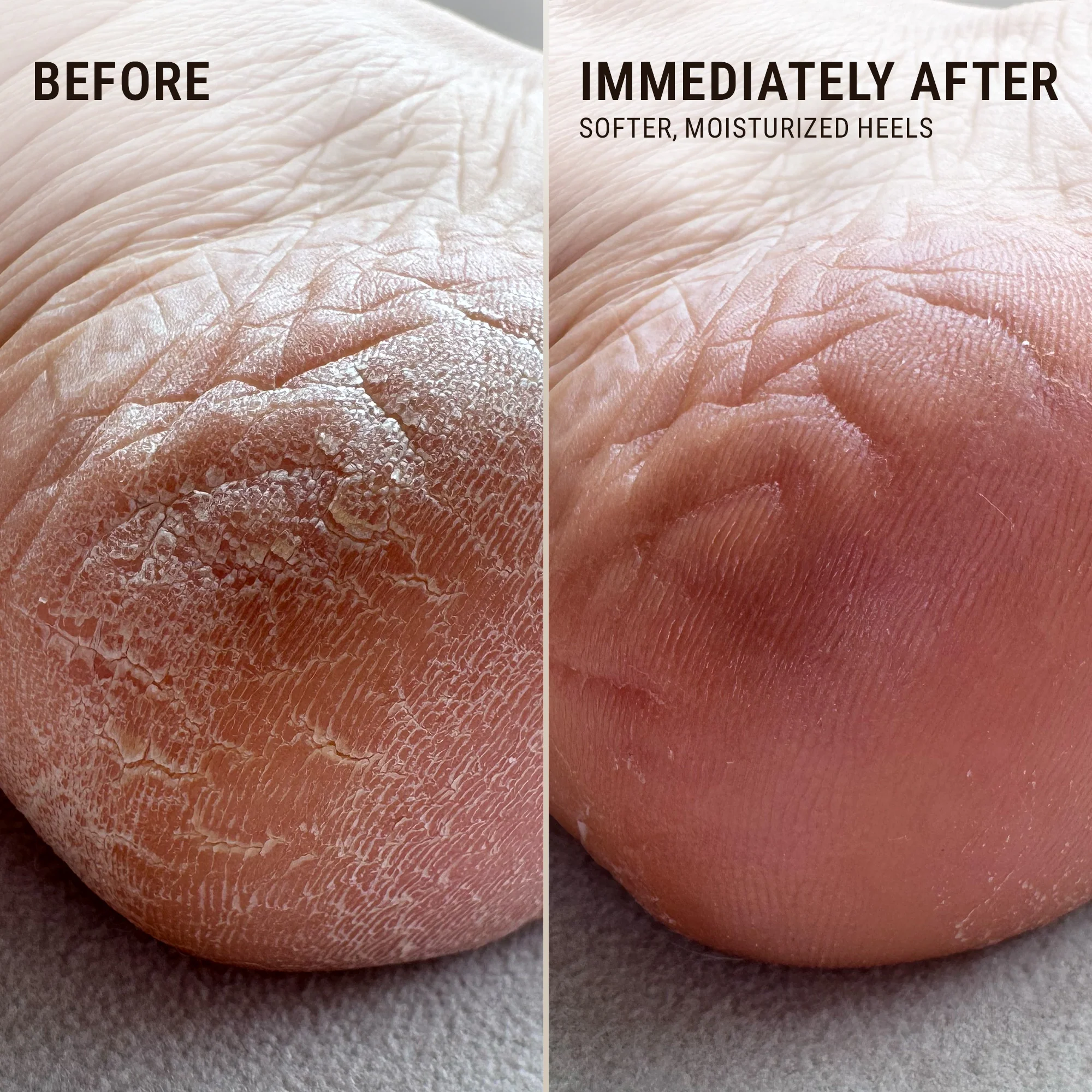 Heel Repair Duo - Image 14