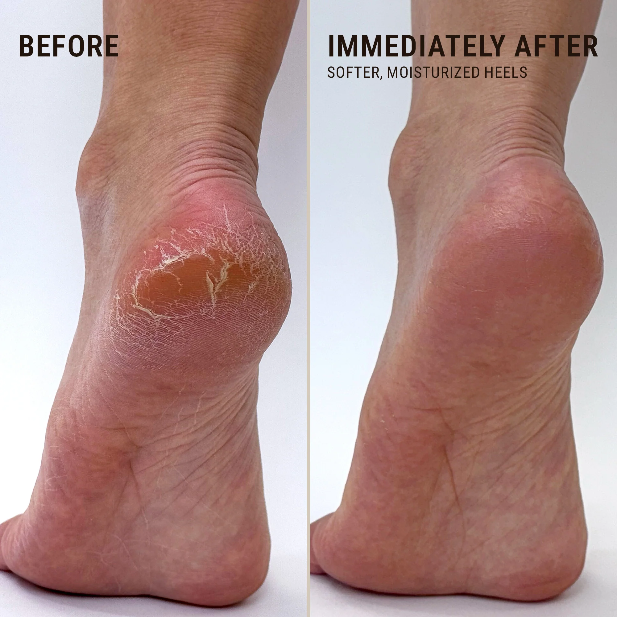 Moisturizing Heel Socks - Image 7